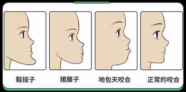 不是所有牙齿不齐都需要“正畸”！这5种牙齿，别急着矫正