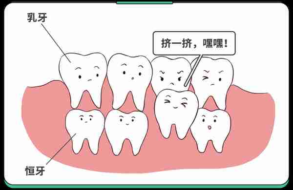 不是所有牙齿不齐都需要“正畸”！这5种牙齿，别急着矫正