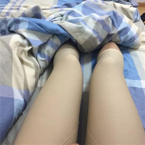 成都大腿吸脂分享