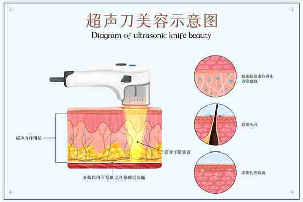 玻尿酸、自体脂肪、肉毒素，哪种除皱效果更好？