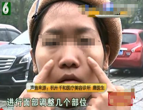 女子花一万元整容，打了两针后气哭：朋友都说我老了十几岁