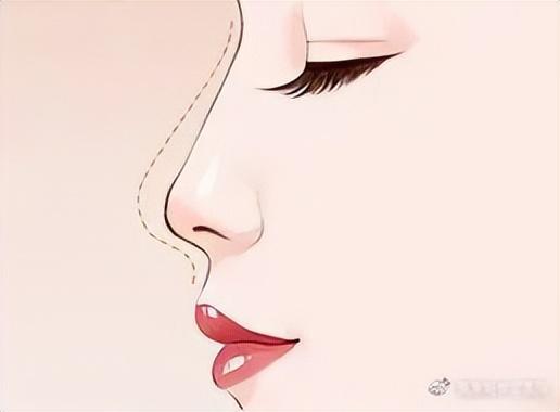 花什么几十万做鼻子？想要隆鼻好看，看完这一篇就够了！