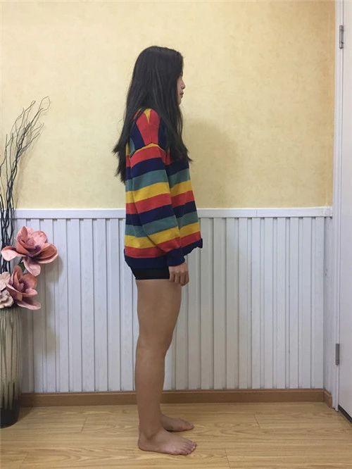 成都大腿吸脂分享