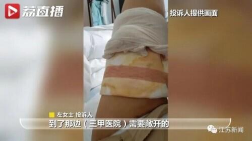 花6万元吸脂后皮肤坏死，双腿凹凸不平！还没修复好，整形医院去哪了？