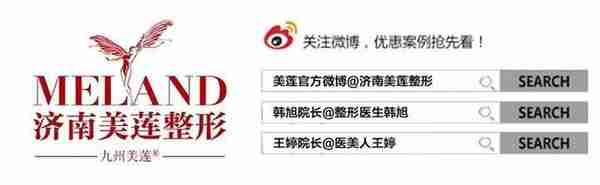 埋线双眼皮效果到底好不好？你的疑问都在这里了