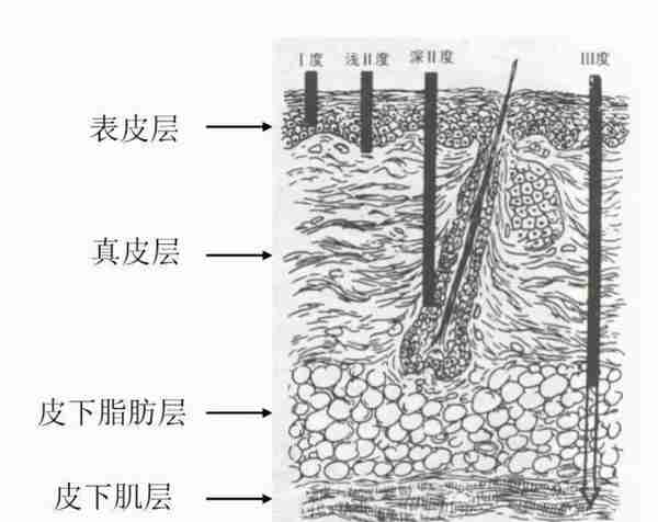 荒野健康：身上可以捏起来的肉可以通过健康的减脂方式减掉的吗？