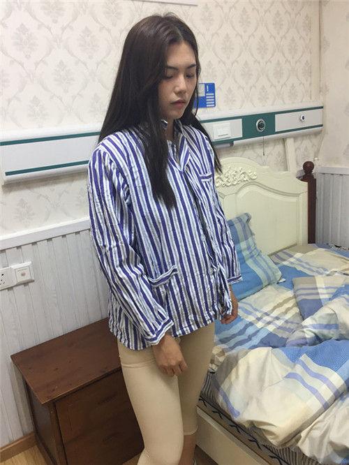 成都大腿吸脂分享