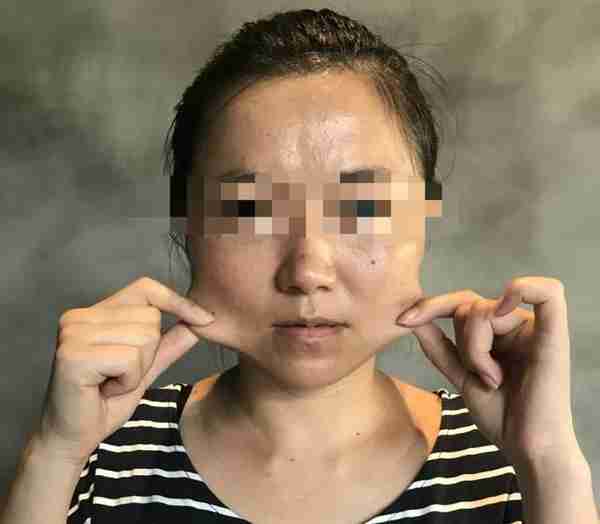 打瘦脸针啊家医院好(打瘦脸针瘦脸医院哪个好)